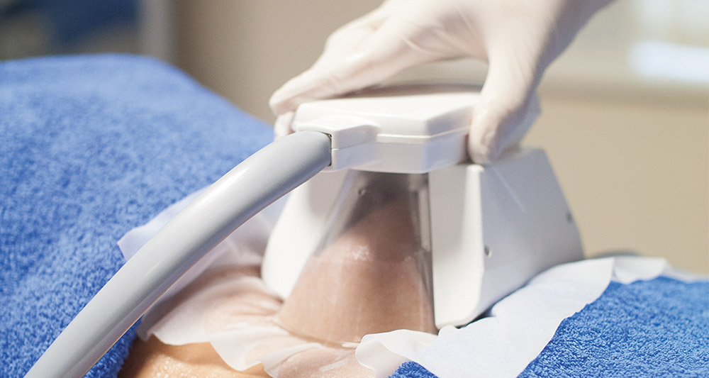 How Fat Freezing and HIFU Work Together? 2 Multiple Areas in One Session HIFU and Fat Freezing Southampton