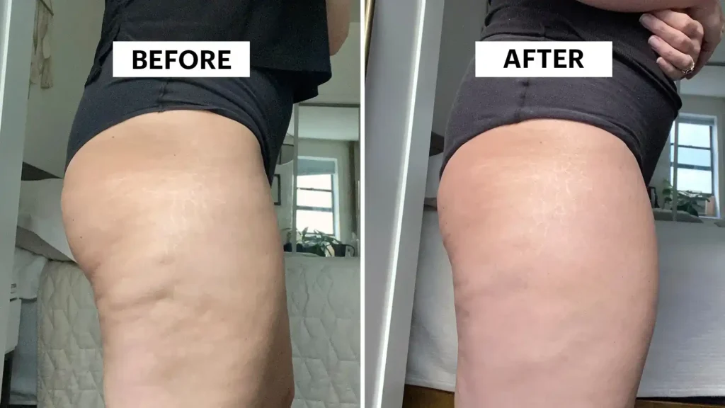 Sculpting Your Bum: Can Toning Exercises Really Reduce Cellulite? 1 Do Toning Exercise Southampton Really Tackle Cellulite?