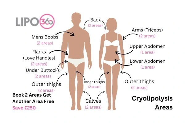 Cryolipolysis fat freezing prices from Lipo 360 Southampton 	
