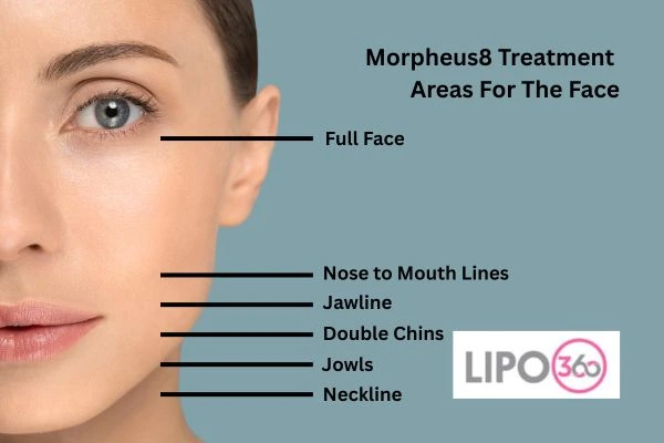 Morpheus8 Southampton 	 Anti ageing treatment! Book in today!
