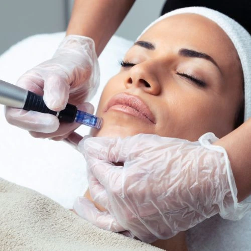 Targeted wrinkle and fine line treatment with Morpheus8 Southampton 	 Book in NOW!