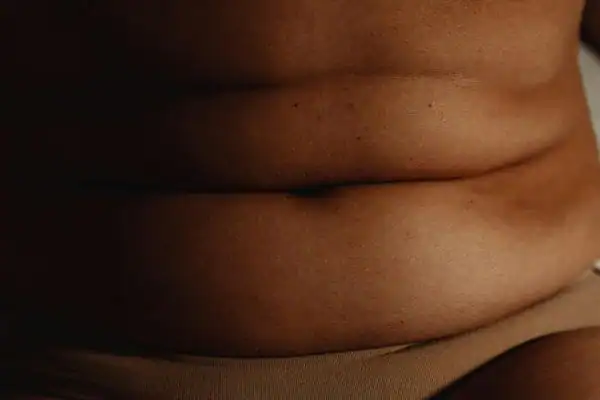image of what stress can do on the stomach area and how Lipo 360 Southampton 	 can help to change your body shape.