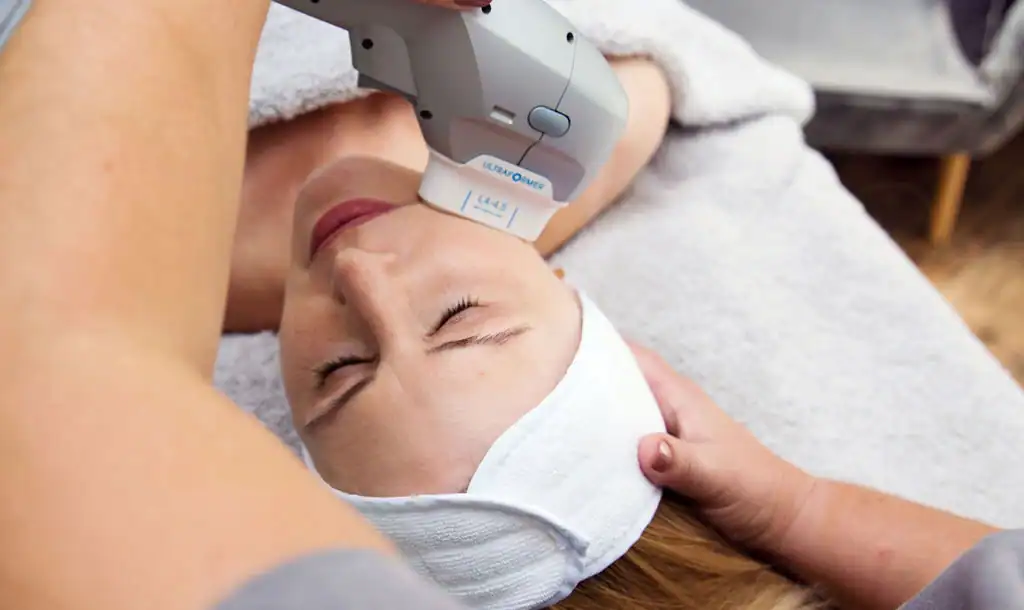 Discover the Perfect Duo: RF Microneedling and HIFU 1 Image of Morpheus8 And HIFU Southampton combined treatment